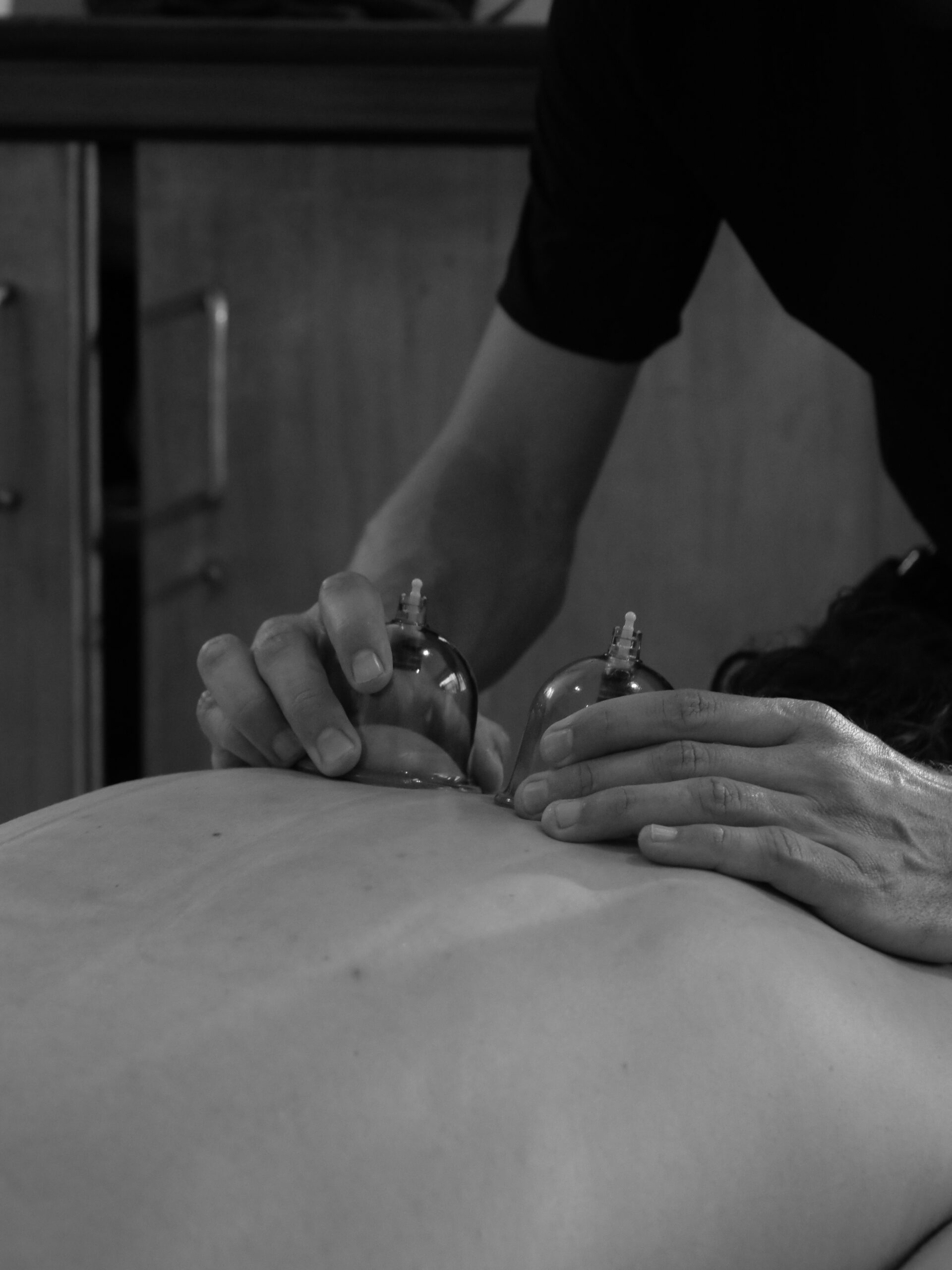 Les Ventouses en Massage Sportif : Cupping Thérapie et Performance